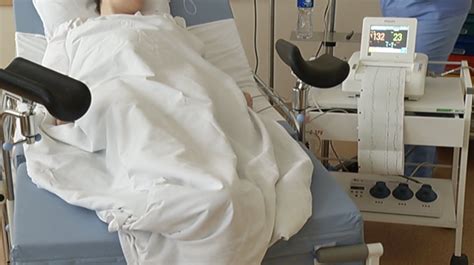 Chirurginis nėštumo nutraukimas procedūra