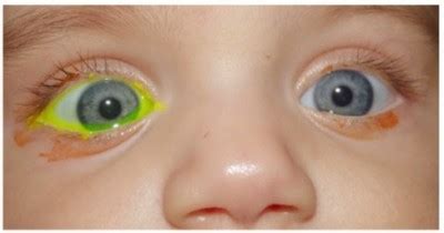 Fluoresceino mėginys