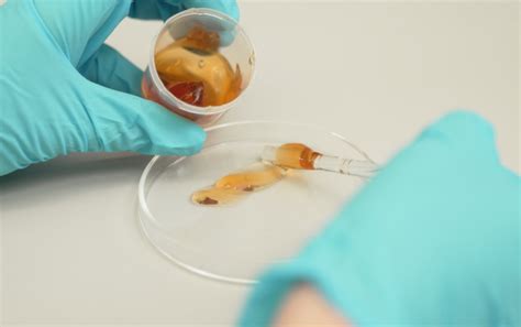 Moteris duoda šlapimo mėginį laboratorijai