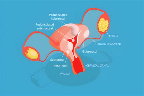 Anatomija moters reprodukcinės sistemos su akcentu ant gimdos kaklelio