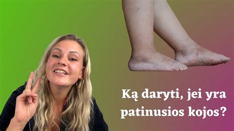 Nėščiosios patinusios kojos