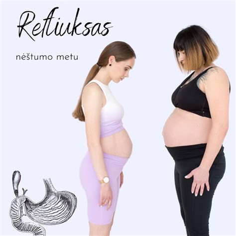 Laikysenos korekcija nėštumo metu