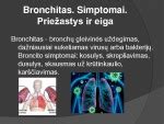 Simptomai ir eiga tridienės karštinės