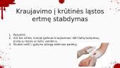 implantacinio kraujavimo schema