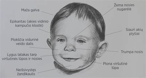 Naujagimio veidas su baltu spuogeliu