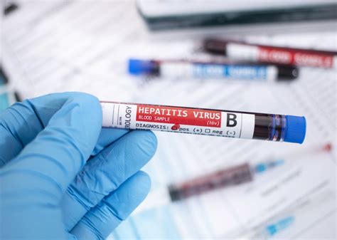 Hepatito A ir B virusų schema