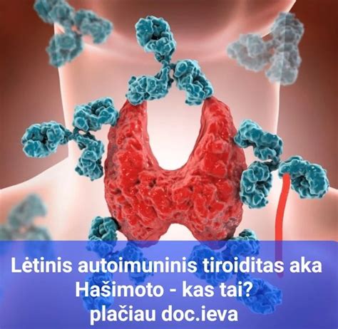 Schematinis skydliaukės fermento TPO pavaizdavimas