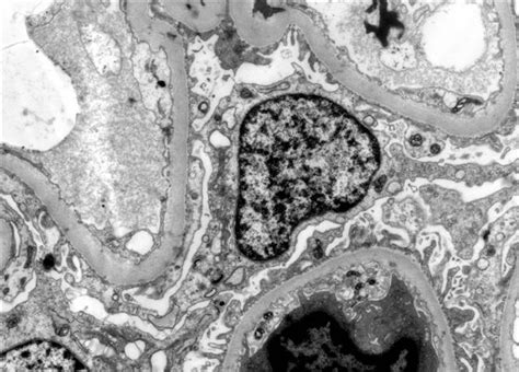 Vėjaraupių viruso elektroninė mikroskopija