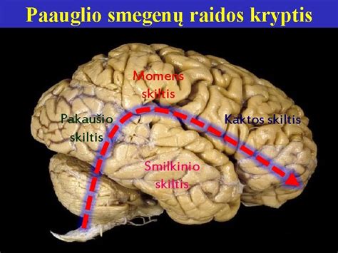 Smegenų raidos diagrama paveikta streso
