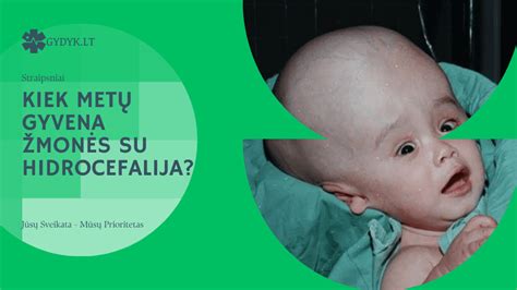 Smegenų skilvelių sistema su hidrocefalija