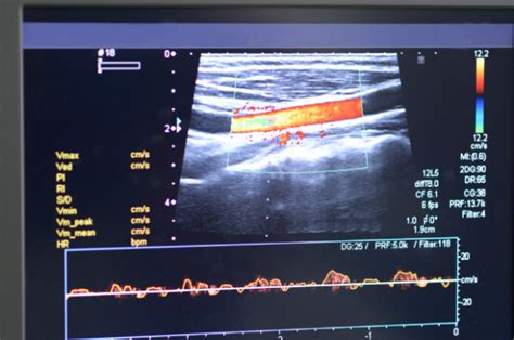 Echoskopijos aparatas ir vaizdas ekrane