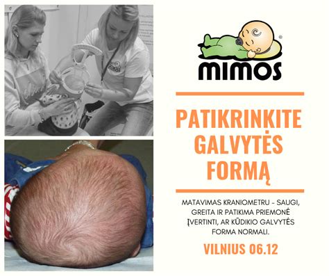 Kūdikio galvytės apimties matavimas