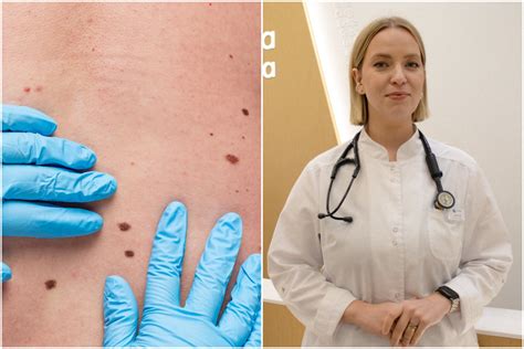 odos tyrimas pas dermatologą
