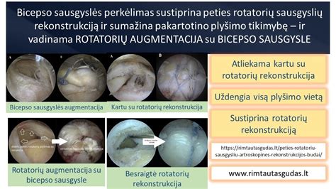 Apyvarpės susiaurėjimo priežastys