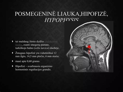 Hormonų reguliavimo schema: pagumburis, hipofizė, kiaušidės