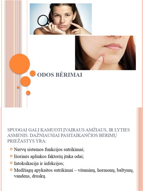 Įvairių tipų naujagimių odos bėrimai (infografika)