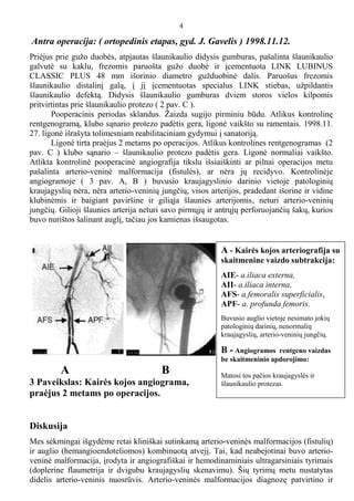 Chirurginio kriptorchizmo gydymo iliustracija
