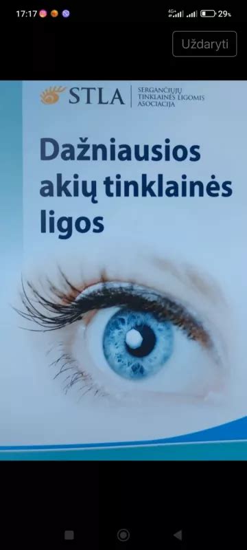 Infografika: dažniausios akių ligos vaikams