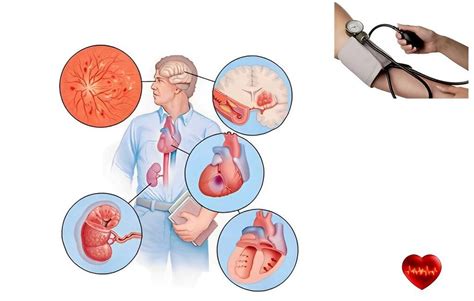 Infografika apie arterinės hipertenzijos komplikacijas