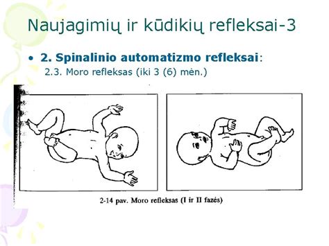 Stangų refleksas ir gimdymo pozos