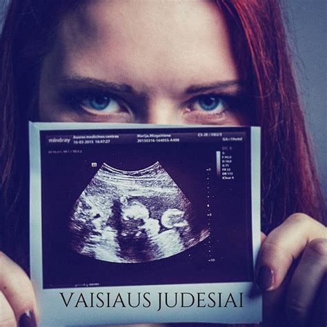Vaisiaus judesiai ultragarso metu