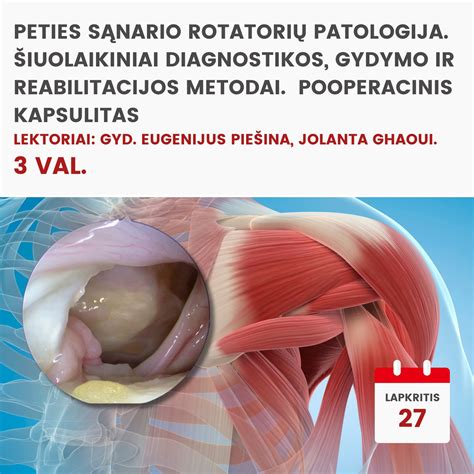 pooperacinis atsigavimas ir judėjimas