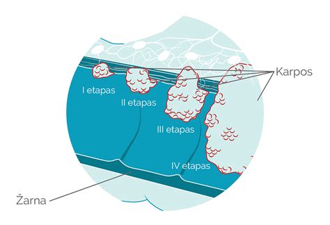 Scheminis išangės ir tiesiosios žarnos paveikslas su paaiškinimais