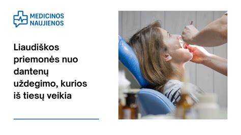 Dantenų uždegimo požymiai