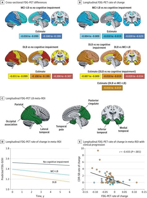Smegenų neuronų tinklas ir pažeidimas sergant demencija