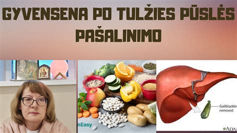Tulžies pūslės ir virškinimo sistemos schema