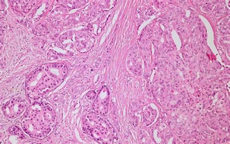 Placentos histologinis tyrimas