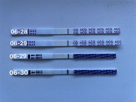 HCG hormono tyrimas laboratorijoje