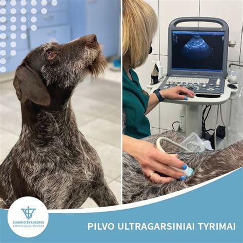 Dvynių priežiūros planas ir ultragarsiniai tyrimai