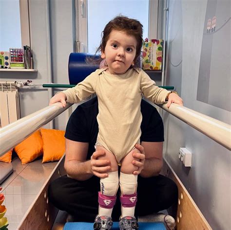 Kūdikis su I tipo spinaline raumenų atrofija, demonstruojantis raumenų silpnumą