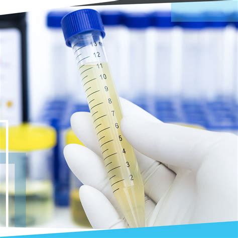 laboratorinis šlapimo tyrimas ir mėgintuvėliai