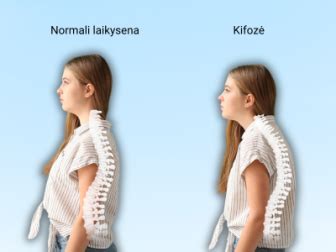Vaikų laikysenos problemos ir stuburo iškrypimas