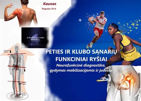 Klubo sąnario displazijos diagnostika ir gydymas kūdikiams