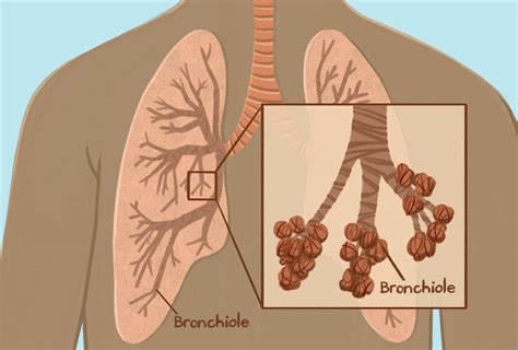 Bronchiolito paveiktos bronchiolės diagrama