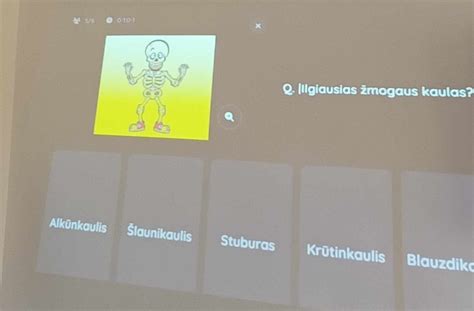 Kaulų skaičiaus pokyčiai žmogaus gyvenime infografika