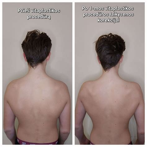 Kūdikio laikysenos prevencija ir korekcija