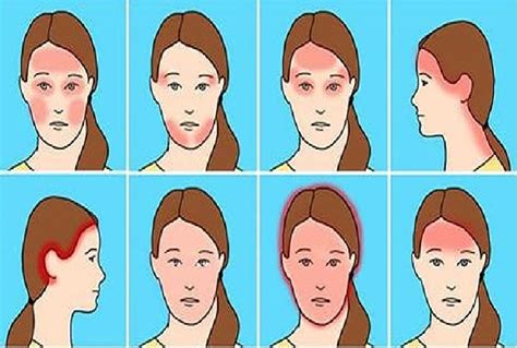 Nėščioji su galvos skausmu