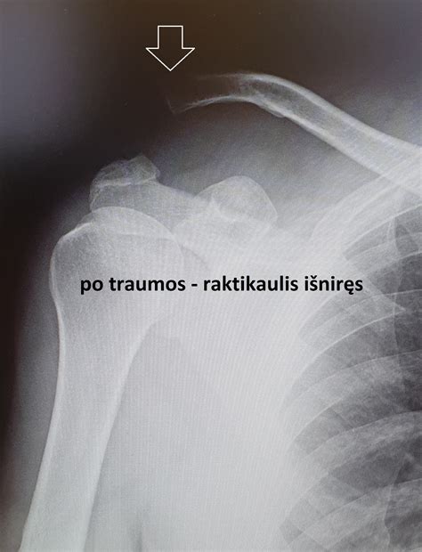 Raktikaulio anatomija