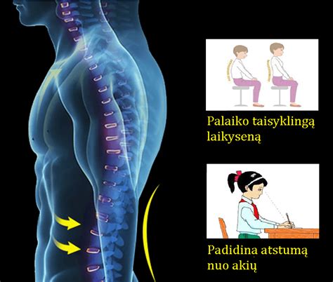 Taisyklingos ir netaisyklingos vaiko laikysenos palyginimo schema