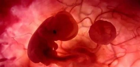 Vaisiaus vystymosi etapai ir galimos anomalijos