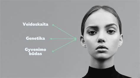 Plagiocefalijos pavyzdys: galvytė iš viršaus atrodo kaip rombas, pastebima veido asimetrija