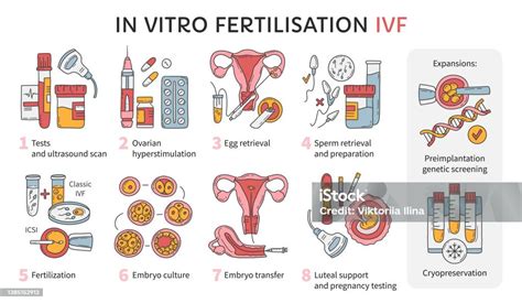 IVF laboratorijos procesų schema