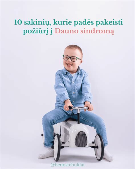Statistika apie Dauno sindromą