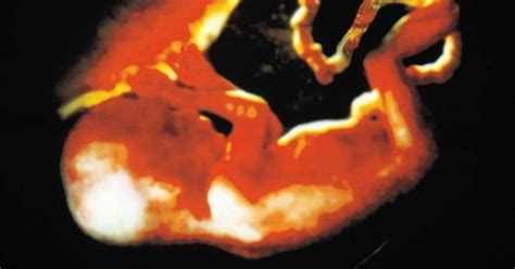 vaisiaus judesiai nėštumo metu schematiškai