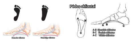 Pėdos atspaudas: normali pėda ir plokščiapėdystė