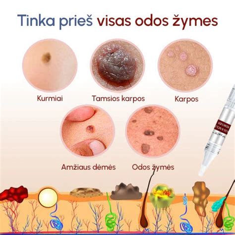 Odos priežiūra po apgamų šalinimo